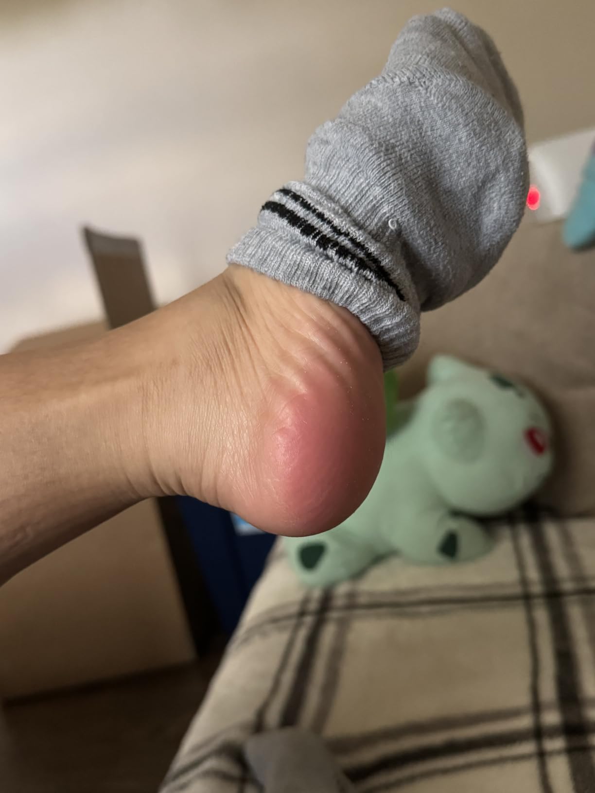 Colossal Foot rasp Foot File and Callus Remover. Best Foot Care Pedicure Metal Surface Tool to Remove Hard Skin. Can be Used on Both Wet and Dry feet, High Grade Stainless Steel File customer photo 1