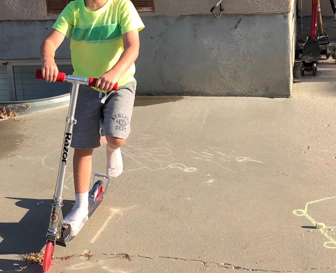 Razor A3 Kick Scooter for Kids Ages 5+ - Larger Wheels, Front Suspension, Wheelie Bar, Lightweight, Foldable, Aluminum Frame, and Adjustable Handlebars customer photo 1