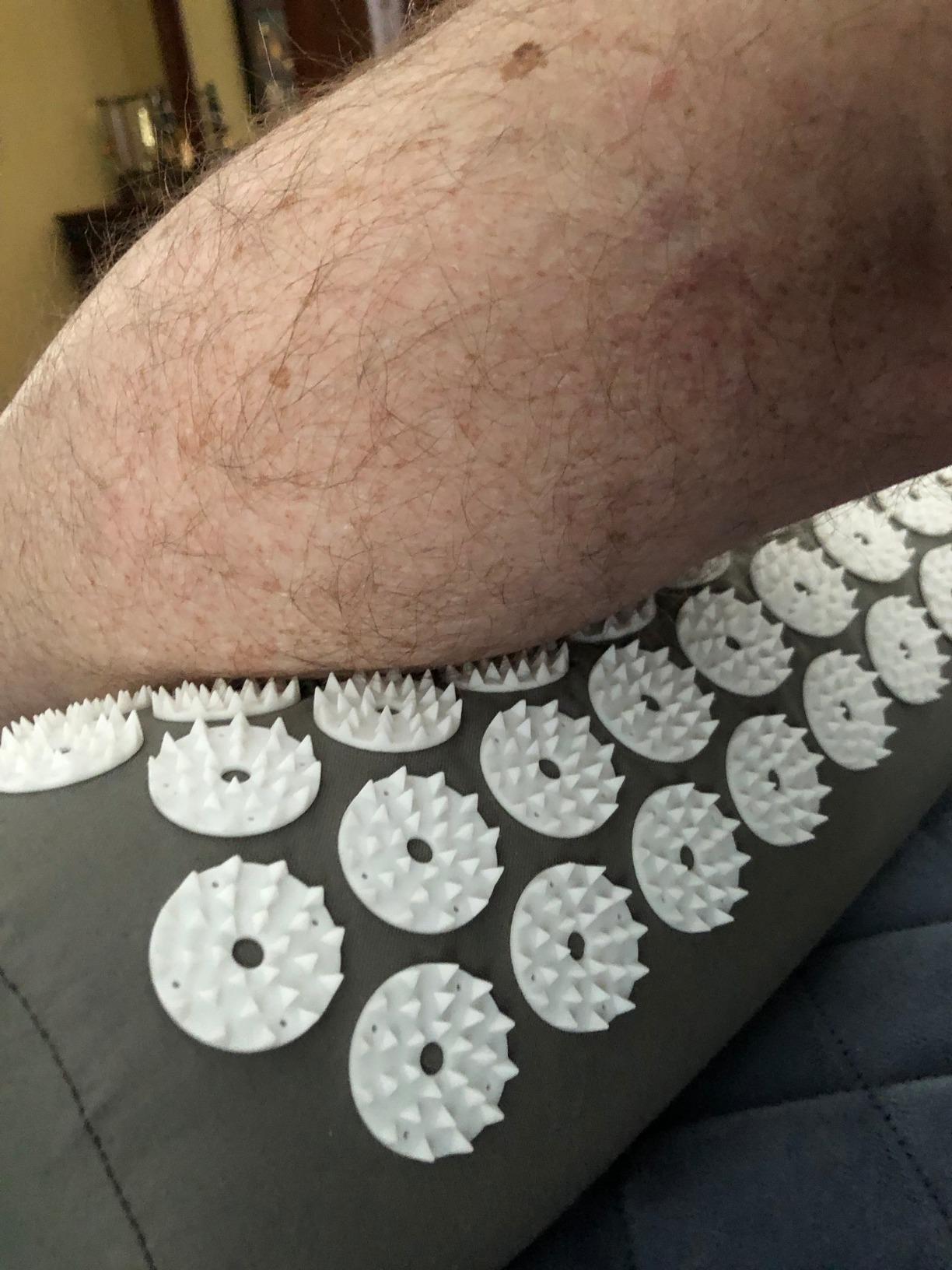 Gaiam Acupressure Mat & Pillow Set, Neck, Shoulder & Back | Acupuncture-Style Stimulation | Neck, Shoulder & Back Tension | Multi-Point Pressure | Home Relaxation Use customer photo 2