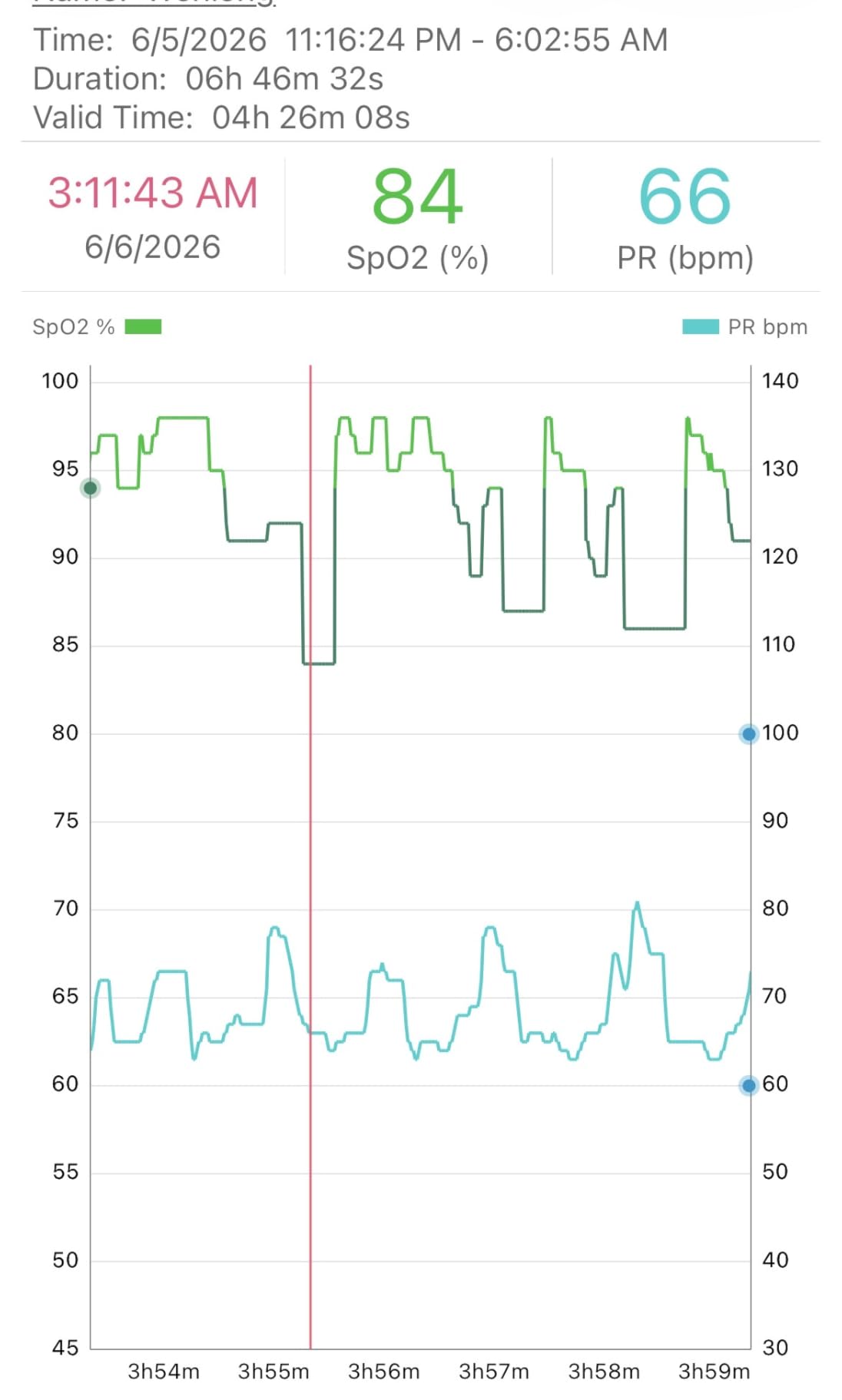 EMAY Sleep Oxygen Monitor with Built-in Recording Capability | Track Continuous Blood Oxygen Levels & Pulse Rate Overnight | Provides Sleep Report & Raw Data customer photo 2