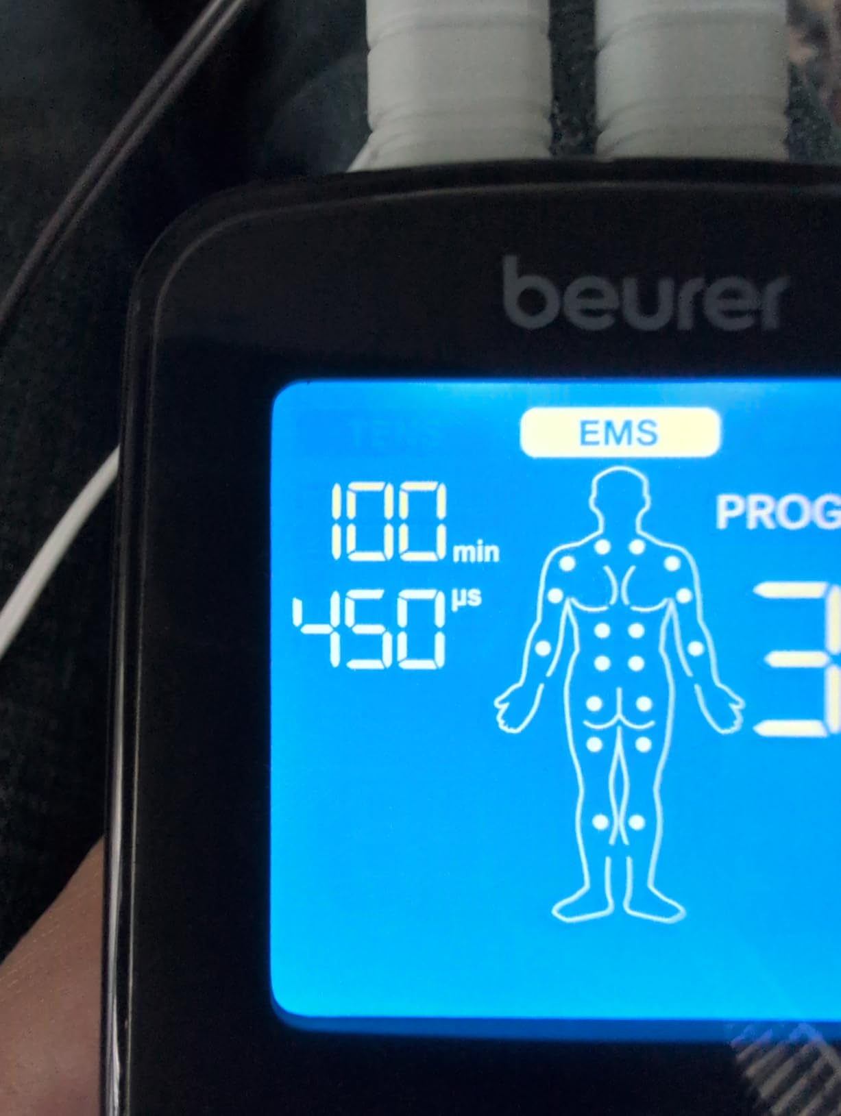 Beurer EM59 Digital 3-in-1 TENS Unit, EMS & Heat Therapy for Pain Relief & Relaxation, Muscle Stimulator with 2 Adjustable Channels, 64 Applications, Timer Function customer photo 2