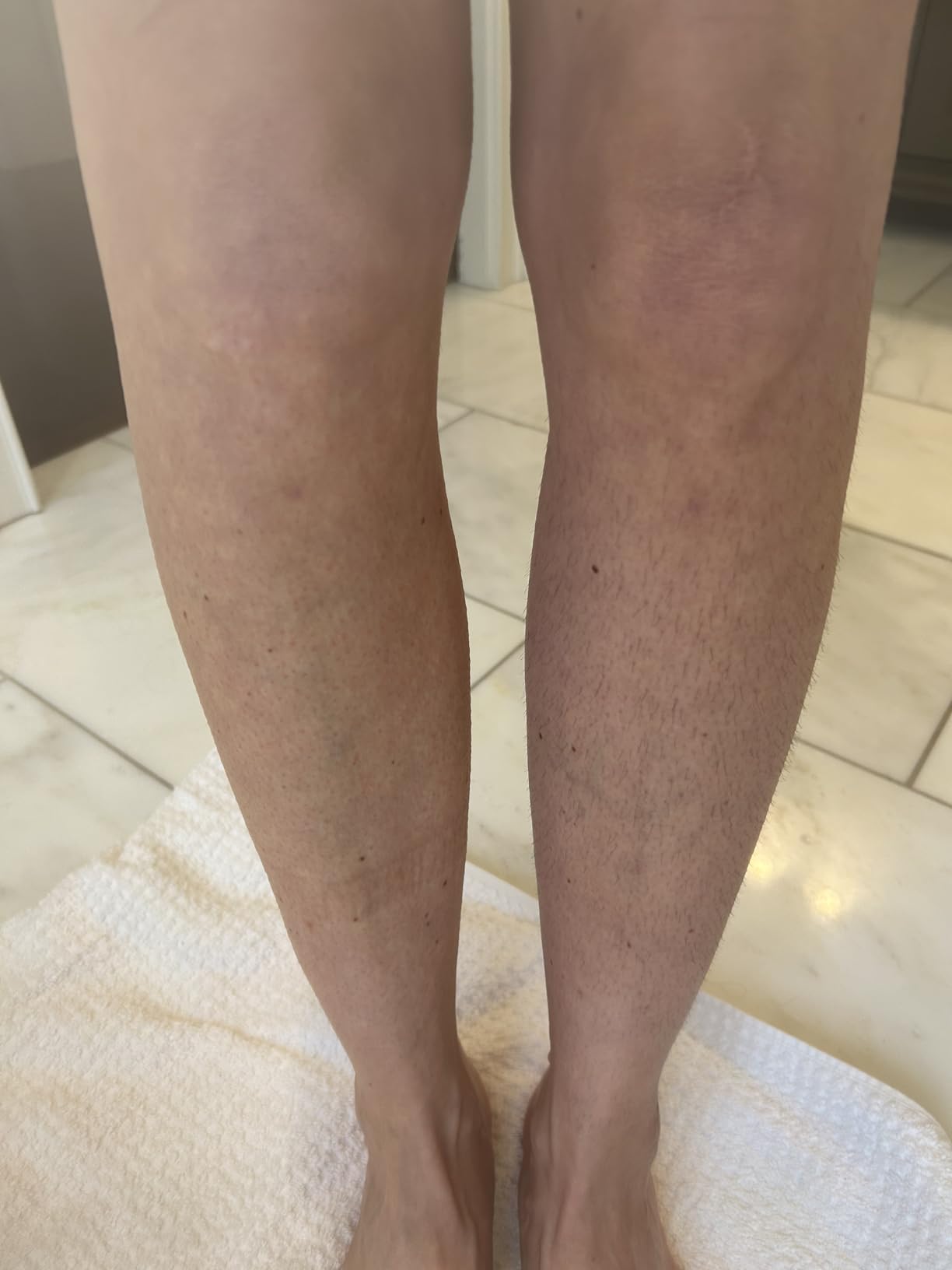 Philips Epilator Series 8000 for Women, with 3 Accessories, BRE700/04 customer photo 2
