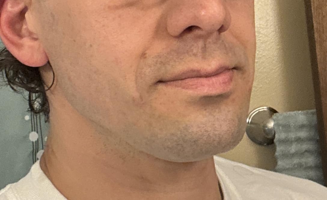 Philips Norelco Shaver 2400 Series, Wet and Dry Electric Shaver, Pop-up Trimmer, P-Cap, Deep Black, Model X3001/90 customer photo 2