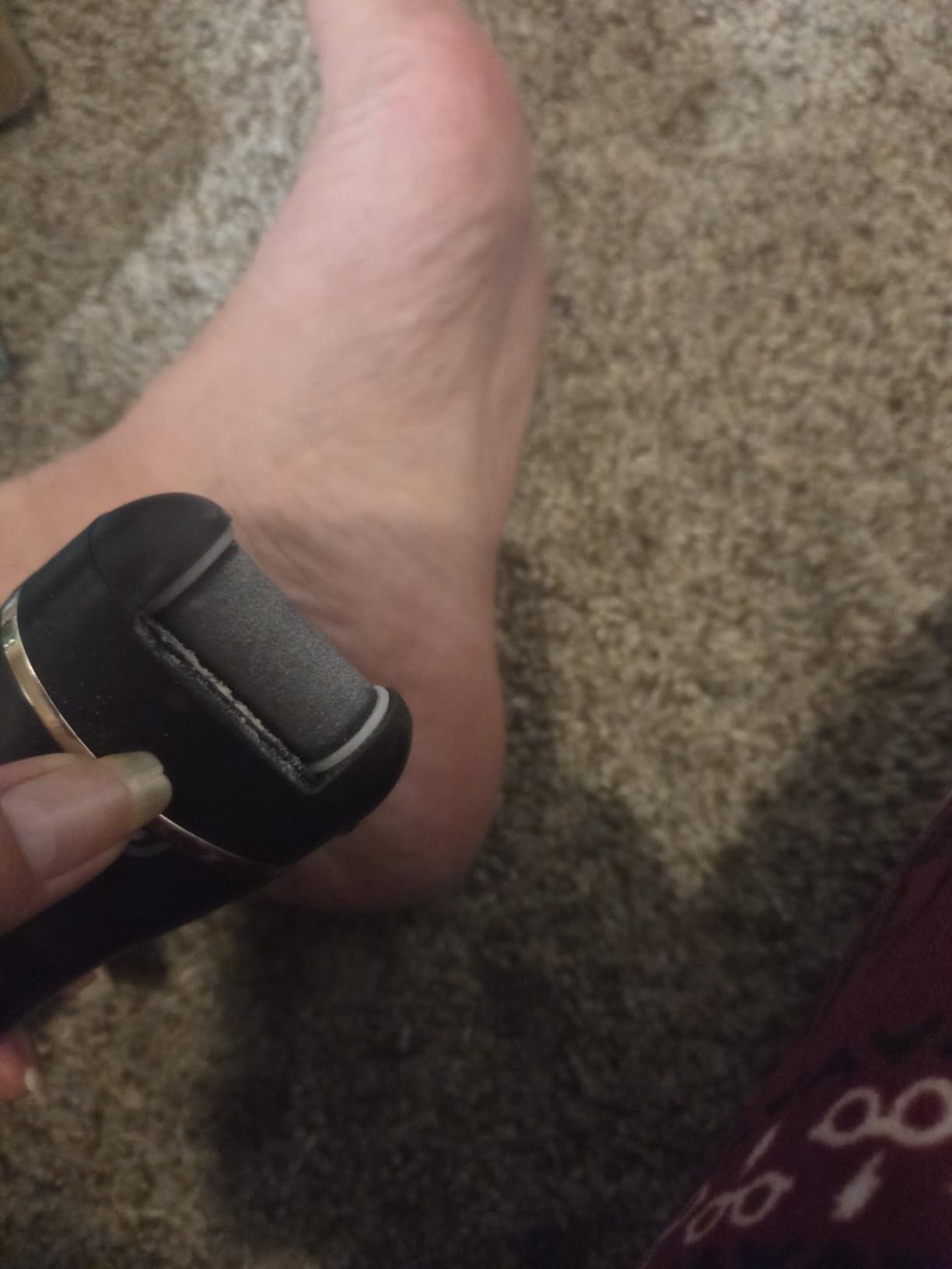 Electric Foot Callus Remover- Long Service Time, Rechargeable Electronic Foot File- Ideal Gift, Professional Pedicure Tools, Waterproof Foot Scrubber, Pedicure Kit Feet Care for Dead Skin (Black) customer photo 2