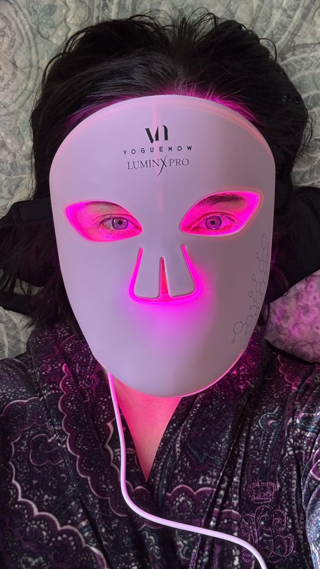 VogueNow LED Light Therapy Mask - FDA-Cleared Device for Wrinkles & Acne - Red Light Therapy for Face with Chin & Lip Coverage - Red, Blue & Near Infrared Facial Skincare Device with 280 LEDs customer photo 1