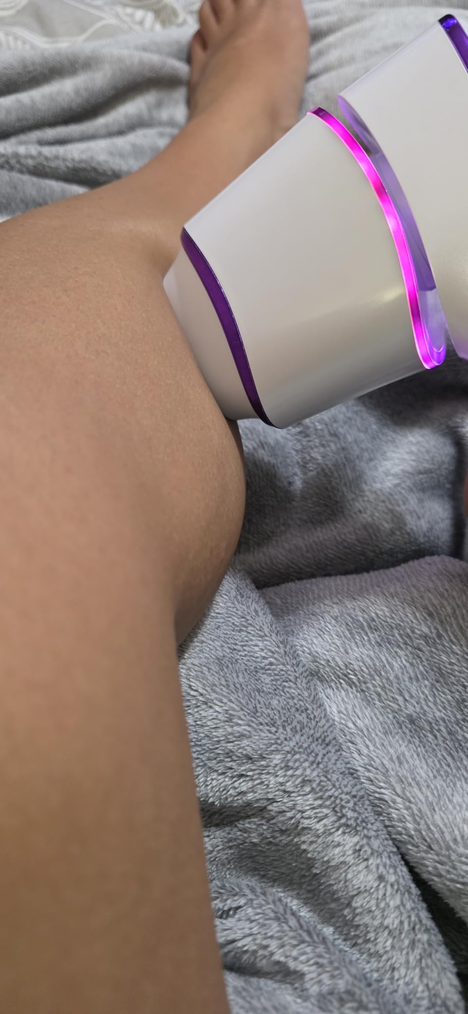 Skin Aurea One Cordless IPL Hair Removal Device 24J for Permanent Hair Reduction - At Home Laser Hair Removal for Women Painless - IPL Laser Hair Removal Device 10 Levels - with Jade Roller & Gua Sha customer photo 1